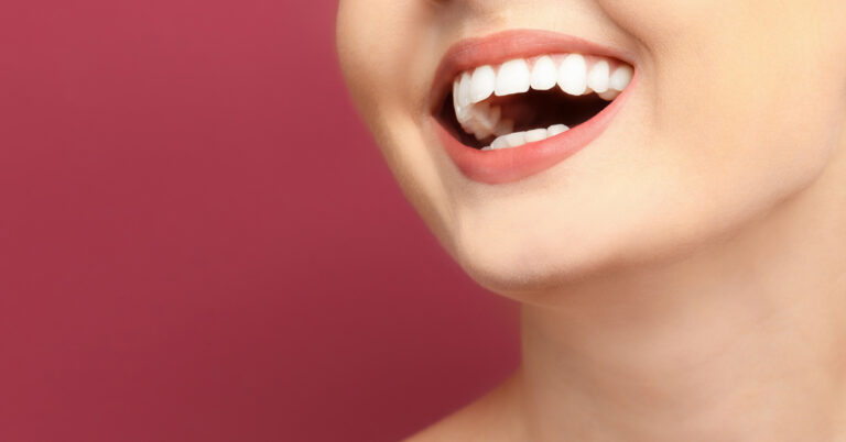 clareamento dental em jaragua do sul